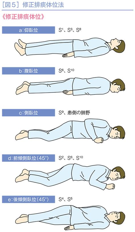 左前傾側臥位